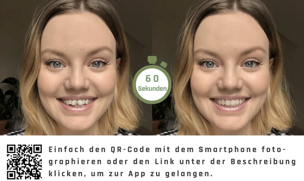 A smiling woman shown in a before-and-after comparison, perfectly illustrating the transformative, confidence-boosting results of orthodontic treatment at Mundwerkstatt.